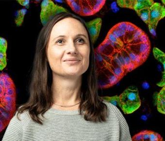 A woman gazes upwards with medium length brown hair in a textured grey sweater set against a brightly colored microscopy slide