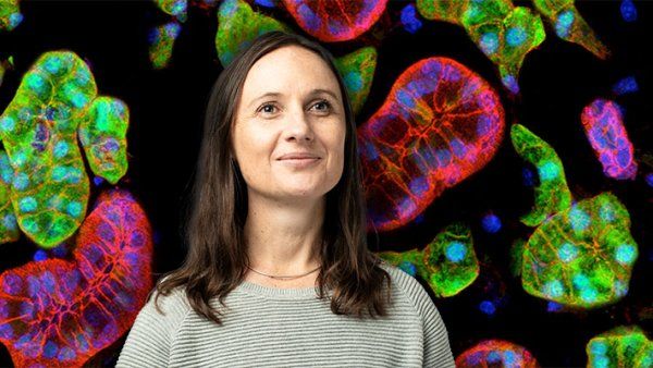 Portrait of Sarah Knox in front of a background of colorful microscopic imagery of acini and ducts in a mouse submandibular salivary gland